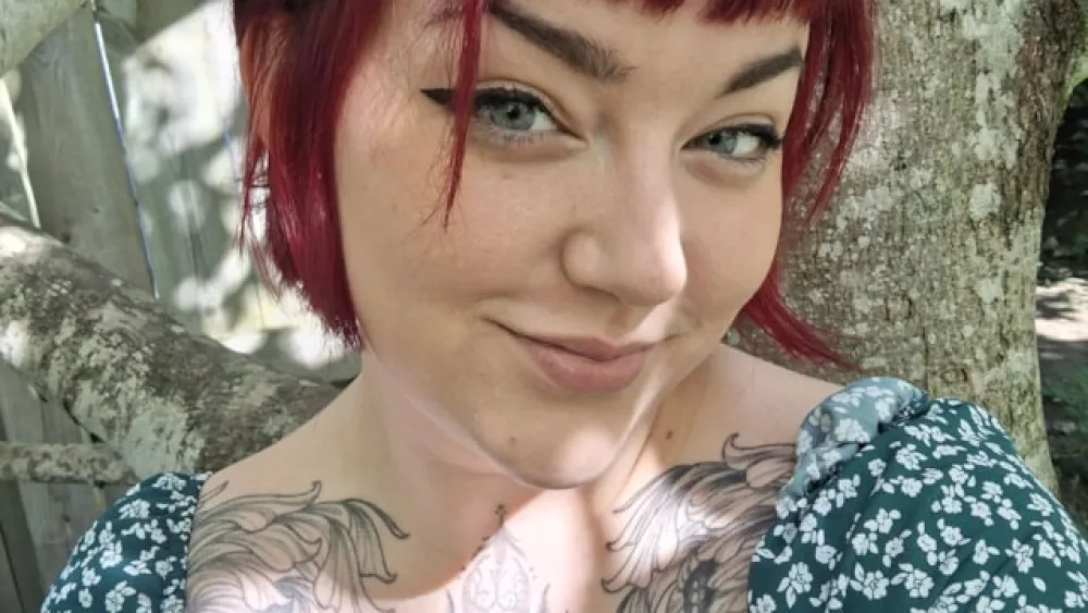 Charlotte McCann, 27, from Huntly in Aberdeenshire, has suffered from endometriosis since she was a teenager